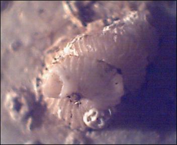 Vermetidae